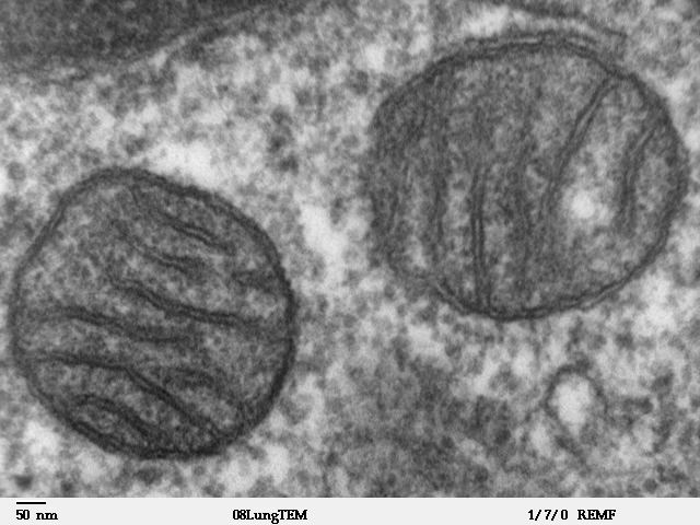 Mitochondria,_mammalian_lung_-_TEM_1